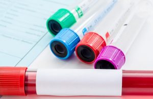 Διατροφικές συμβουλές για επιτυχή αιμοδοσία