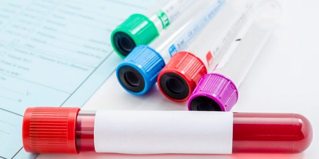 diatrofikes-symvoules-gia-epityxi-aimodosia_15319_XL