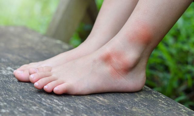 kounoupi_tsimpima (1)