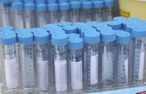 Κορονοϊός: Φτιάχτηκε τεστ που ανιχνεύει σε μία ώρα όσους θα νοσήσουν βαριά