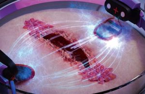 Πώς ο ηλεκτρισμός μπορεί να επουλώσει πιο γρήγορα τις πληγές σου