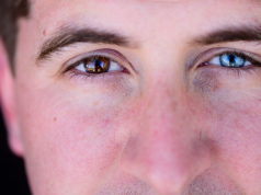 Μάτια: Γιατί δεν πρέπει να τα τρίβουμε