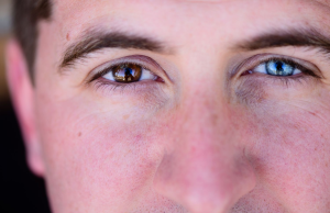 Μάτια: Γιατί δεν πρέπει να τα τρίβουμε